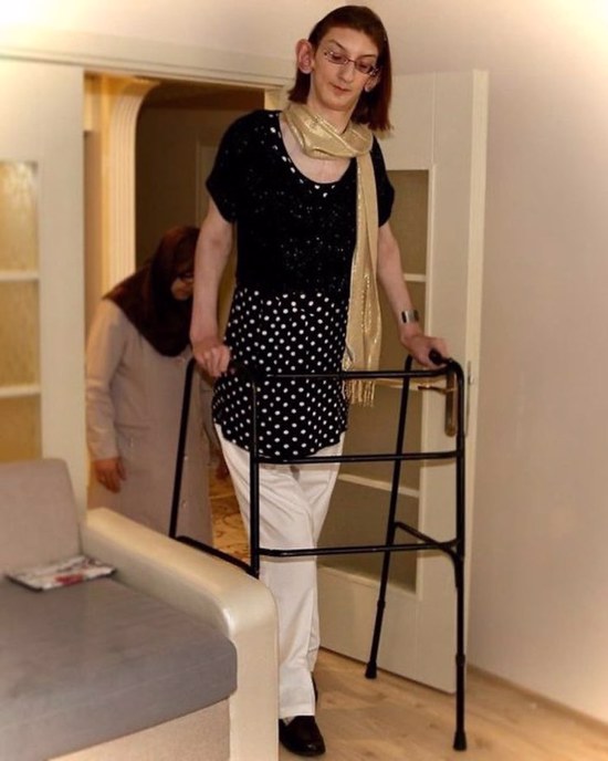 أطول امرأة في العالم .. المواطنة التركية رميساء تدخل موسوعة غينيس